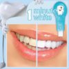 أداة تبييض الأسنان أداة تبييض الأسنان العناية الشخصية